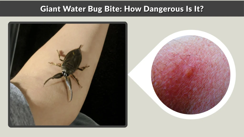 Giant Water Bug Bite How Dangerous Is It