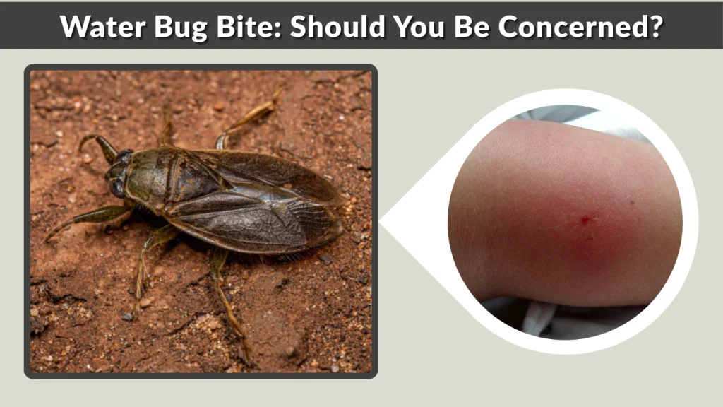 Water Bug Bite Should You Be Concerned
